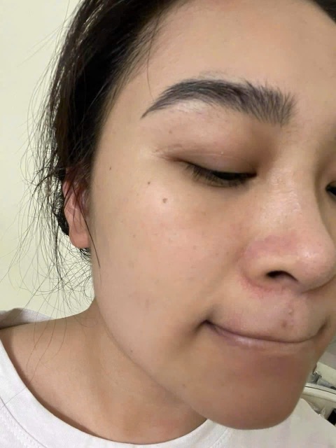 Trước Hydra