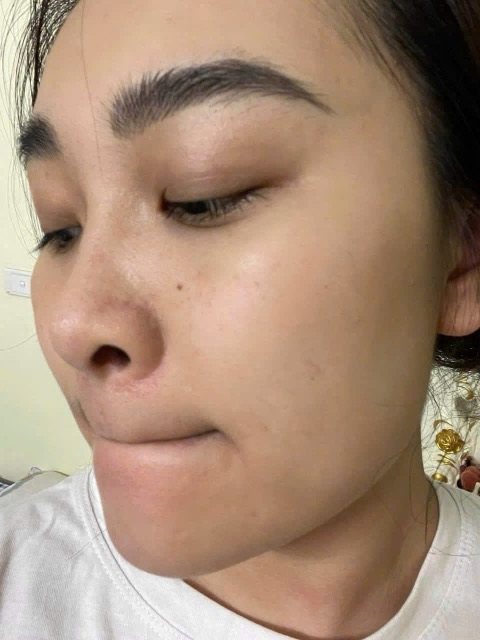 Trước Hydra