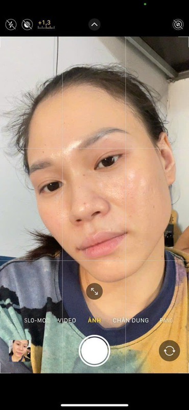 Sau liệu trình