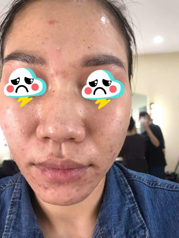 Trước liệu trình