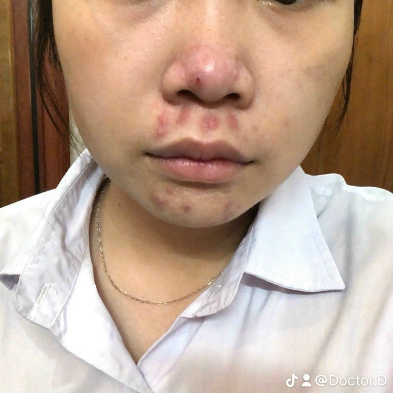 Trước liệu trình