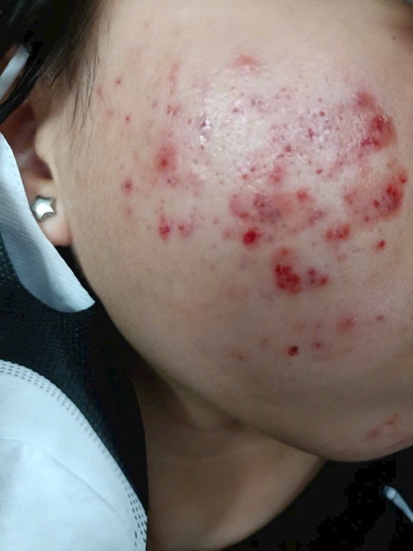 Trước liệu trình